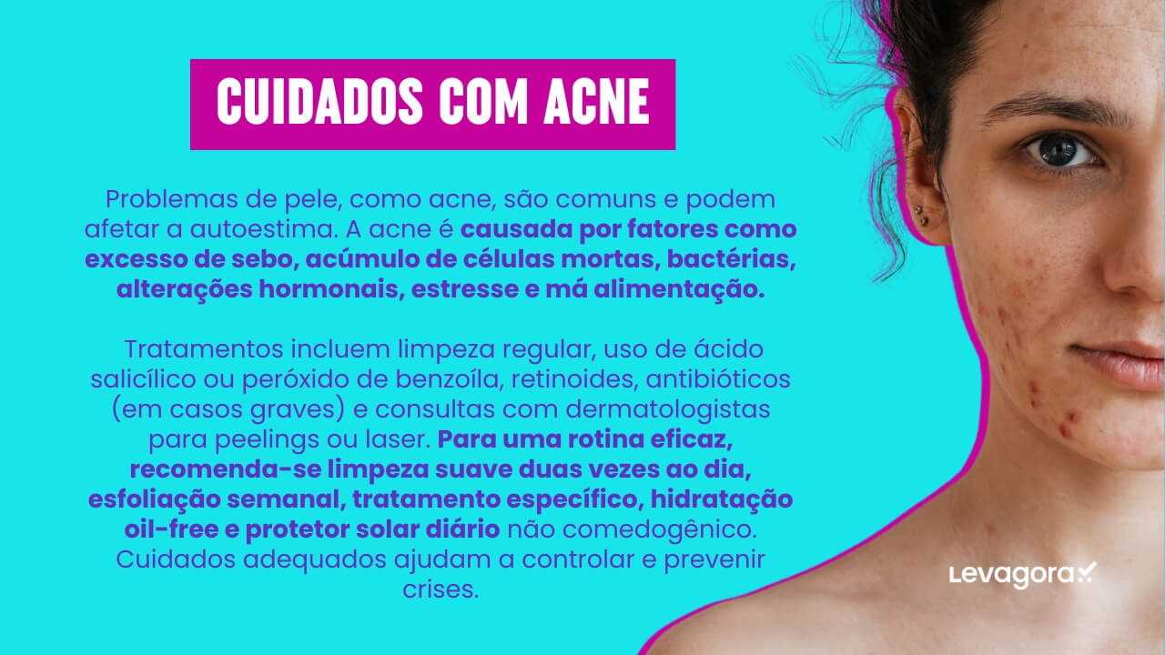Cuidados com Acne