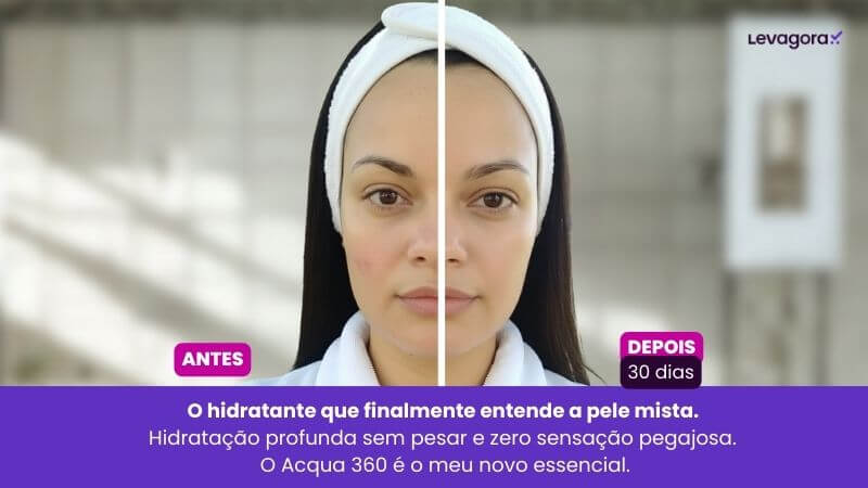 Review Acqua 360 Imagem comparativa de "Antes" e "Depois" dividida por uma linha branca vertical no centro do rosto de uma mulher. O lado esquerdo (Antes) mostra uma bochecha levemente avermelhada e ressecada. O lado direito (Depois) apresenta a pele visivelmente mais uniforme, hidratada e com viço natural. Na parte inferior, um banner roxo contém o texto: "O hidratante que finalmente entende a pele mista. Hidratação profunda sem pesar e zero sensação pegajosa."